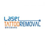 Laser Tattoo Removal Brisbane