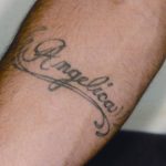 Laser Tattoo Removal Brisbane